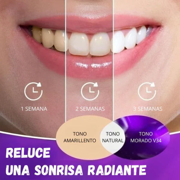 PACK BLANQUEAMIENTO DENTAL